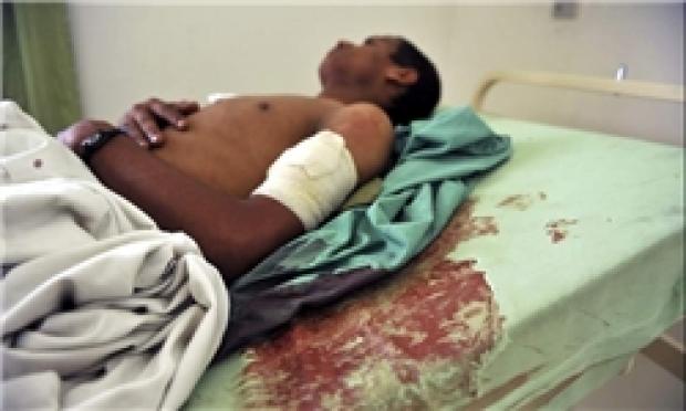 مرگ بیش از ۱۱ هزار و ۲۵۰ بیمار یمنی به دلیل محاصره عربستان